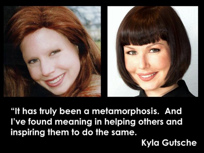 After surviving ovarian cancer at the age of 26, Kyla Gutsche was left without eyebrows. After undergoing two unsuccessful cosmetic procedures, Kyla decided to apply her own visual arts background so that others could avoid similar experiences and have the renewed confidence to face and enjoy the world. (Graphic: Cosmetic Transformations)