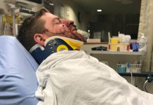 According to a public post on Facebook, Cody Wellman of Peterborough was assaulted early on Sunday morning outside The Social pub in downtown Peterborough, suffering a broken jaw and nose among other injuries. (Photo: Aimee Wellman / Facebook)