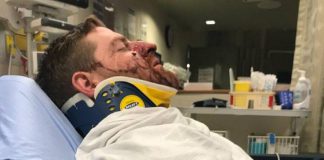 According to a public post on Facebook, Cody Wellman of Peterborough was assaulted early on Sunday morning outside The Social pub in downtown Peterborough, suffering a broken jaw and nose among other injuries. (Photo: Aimee Wellman / Facebook)