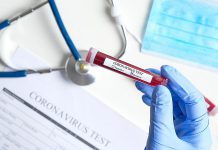 A medical professional holding a vial marked "Coronavirus Test" with "Positive" checked to indicate a positive COVID-19 test. (Stock photo)