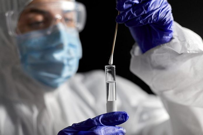 A COVID-19 test being conducted in a laboratory. (Stock photo)