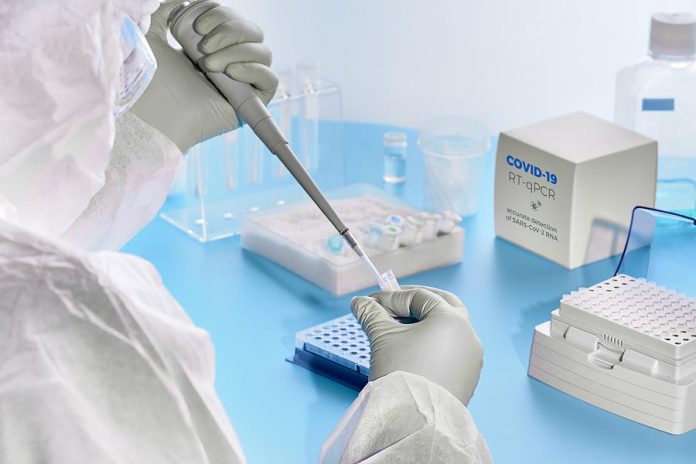 COVID-19 tests in a laboratory. (Stock photo)