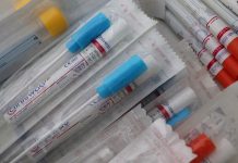 COVID-19 lab test swabs. (Stock photo)