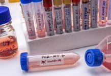 COVID-19 variants of concern. (Stock photo)