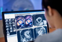 Magnetic resonance imaging (MRI) is a non-invasive imaging technology that produces detailed three-dimensional scans of the body's organs and tissues and is often used for disease detection, diagnosis, and treatment monitoring. (Photo: Philips)