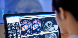 Magnetic resonance imaging (MRI) is a non-invasive imaging technology that produces detailed three-dimensional scans of the body's organs and tissues and is often used for disease detection, diagnosis, and treatment monitoring. (Photo: Philips)