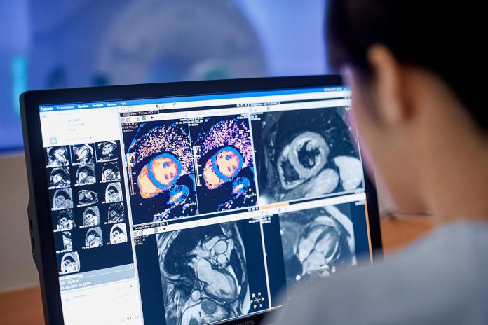 Magnetic resonance imaging (MRI) is a non-invasive imaging technology that produces detailed three-dimensional scans of the body's organs and tissues and is often used for disease detection, diagnosis, and treatment monitoring. (Photo: Philips)