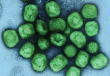 A colourized transmission electron micrograph of monkeypox virus particles (green) cultivated and purified from cell culture. (Photo: National Institute of Allergy and Infectious Diseases)