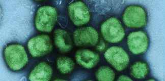 A colourized transmission electron micrograph of monkeypox virus particles (green) cultivated and purified from cell culture. (Photo: National Institute of Allergy and Infectious Diseases)
