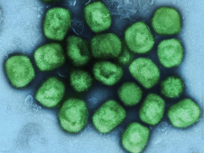 A colourized transmission electron micrograph of monkeypox virus particles (green) cultivated and purified from cell culture. (Photo: National Institute of Allergy and Infectious Diseases)