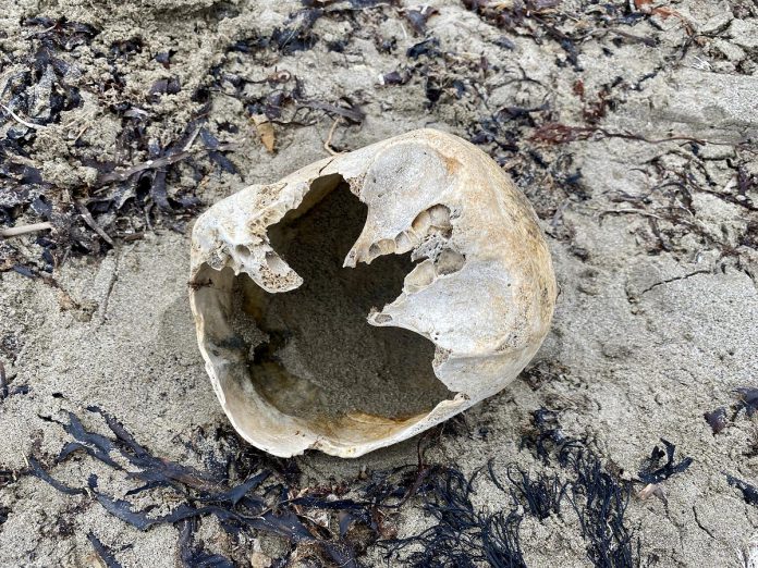 While on vacation in Nova Scotia, Peterborough's Paul Rellinger Jr. and his wife Olivia were walking along Big Glace Bay Beach at Port Caledonia on Cape Breton Island, along with their friend Robyn, when they found a suspected human skull. (Photo: Paul Rellinger Jr.)