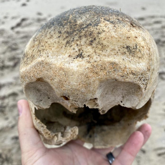 After determining the object they found was likely a human skull, the Rellingers reported their find to police, who arrived to document the skull and two other bones found nearby and send them to the medical examiner in Halifax for further investigation. (Photo: Paul Rellinger Jr.)