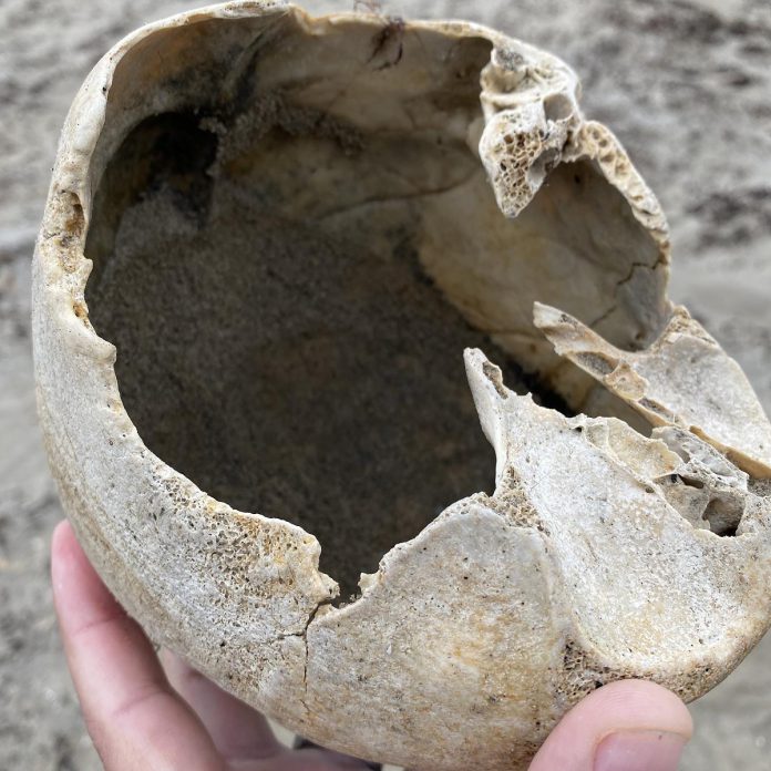 There are several possible explanations for the presence of a human skull on the beach, including the erosion of seaside cemeteries. (Photo courtesy of Paul Rellinger Jr.)