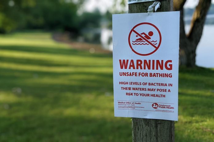 A notice from Peterborough Public Health that the water is unsafe for swimming at Roger's Cove in Peterborough on June 18, 2024. (Photo: Bruce Head / kawarthaNOW)