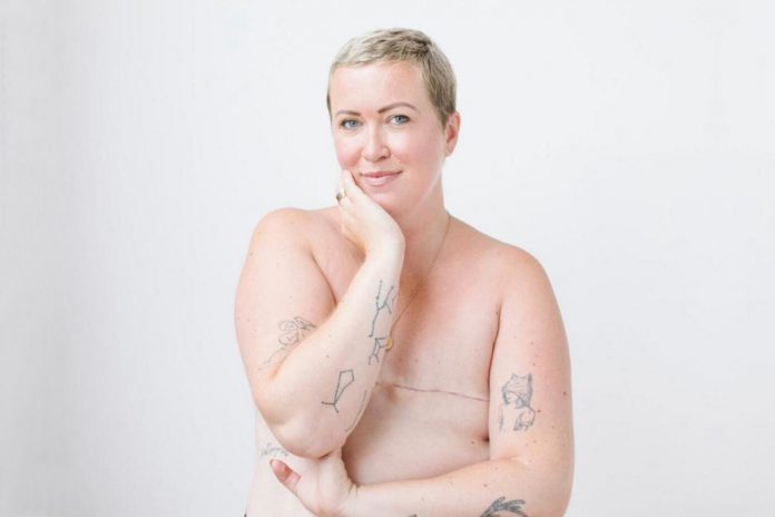 From losing her hair during cancer treatment to choosing to undergo a double mastectomy, Cobourg native Leisse Wilcox has had to redefine her relationship with her body, femininity, and the concept of being "enough." She will share her journey of embracing herself after cancer and redefining her identity in the "Speaker Slam's 8th Annual Grand Slam" competition on November 9, 2024 in Toronto. (Photo supplied by Speaker Slam)