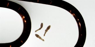 The Echinococcus multilocularis tapeworm is a tiny parasite that lives in the intestines of canids like coyotes, foxes, wolves, and dogs. Three of the adult tapeworms are shown in this photograph that includes a paper clip for scale. (Photo: Brent Wagner / Jenkins Lab, University of Saskatchewan)