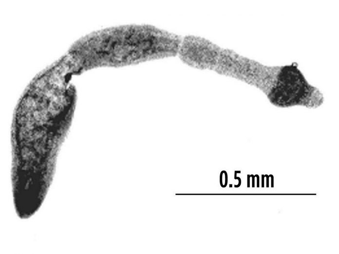 Echinococcus multilocularis isolated from a fox in Hungary. Scale bar is half a millimetre. (Photo: U.S. Centers for Disease Control and Prevention)